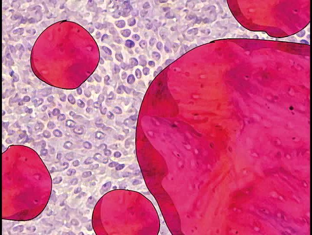 Sing no sad songs for me-1's Cover