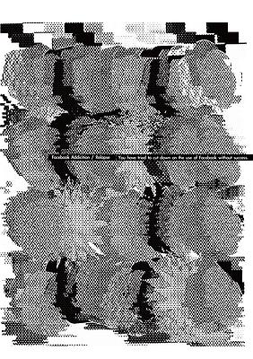 扭曲7