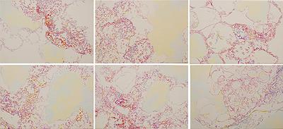 微觀之下的變異幻象–5