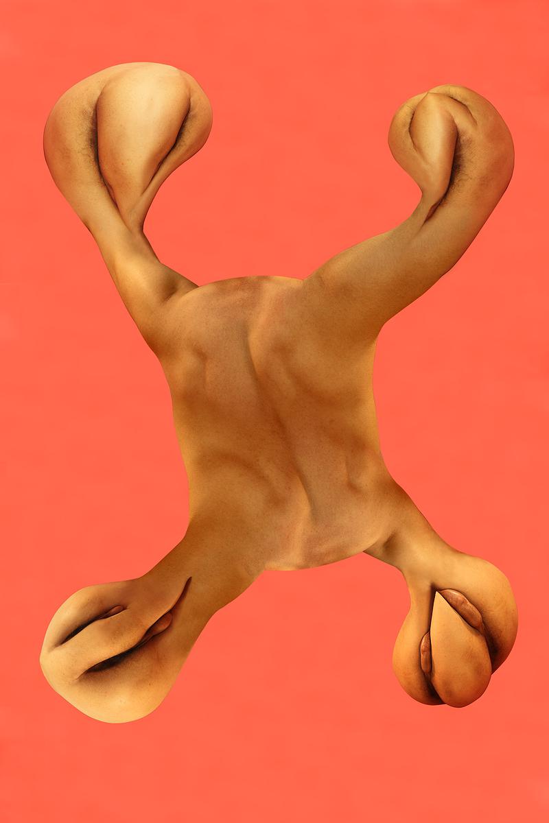 The Injection of Rubber Prostate—4's Cover