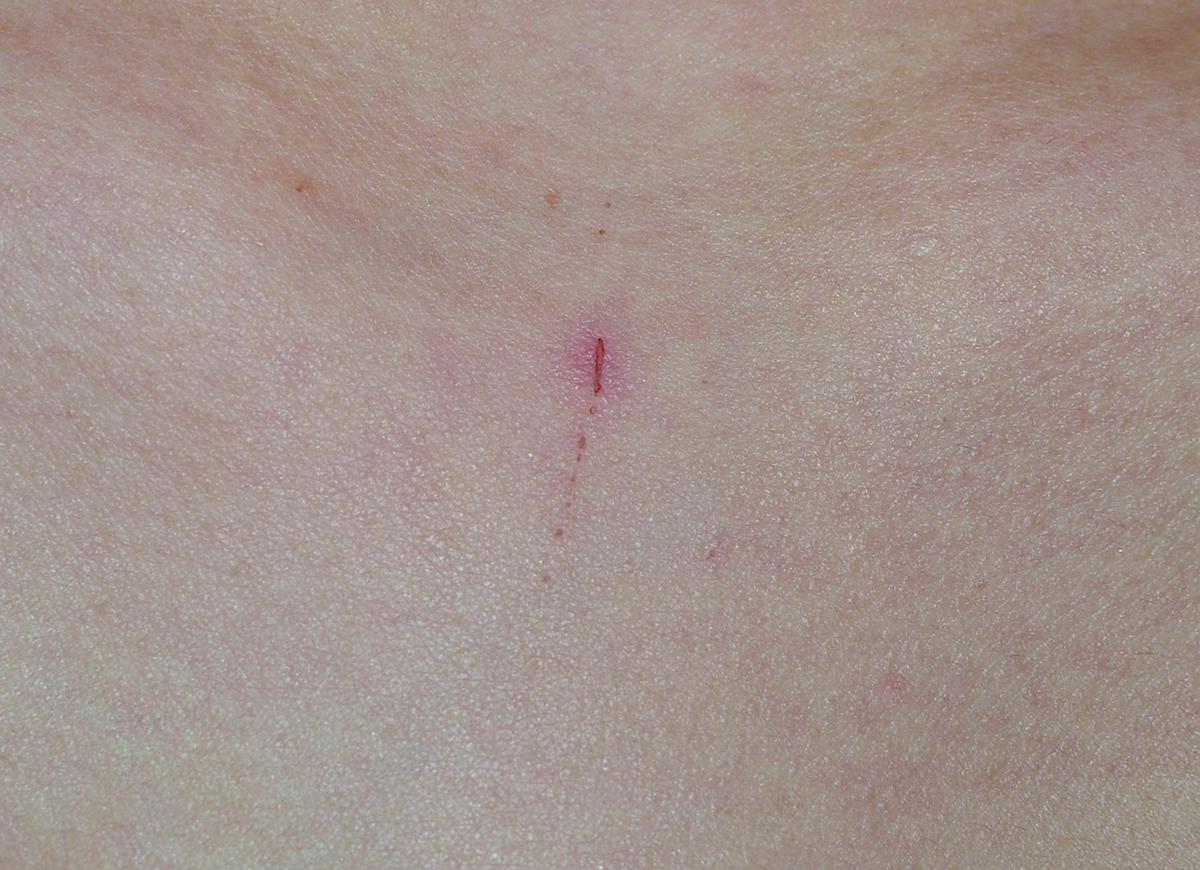 短暫的記憶_12的封面圖