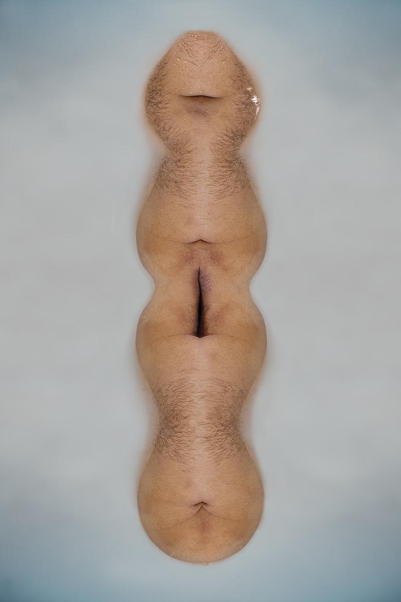 The Injection of Rubber Prostate—8's Cover