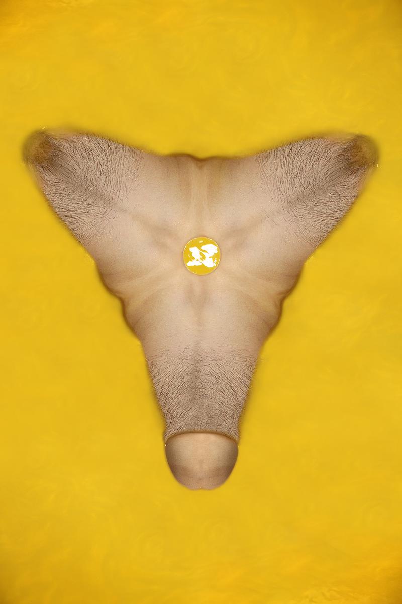 The Injection of Rubber Prostate—9's Cover