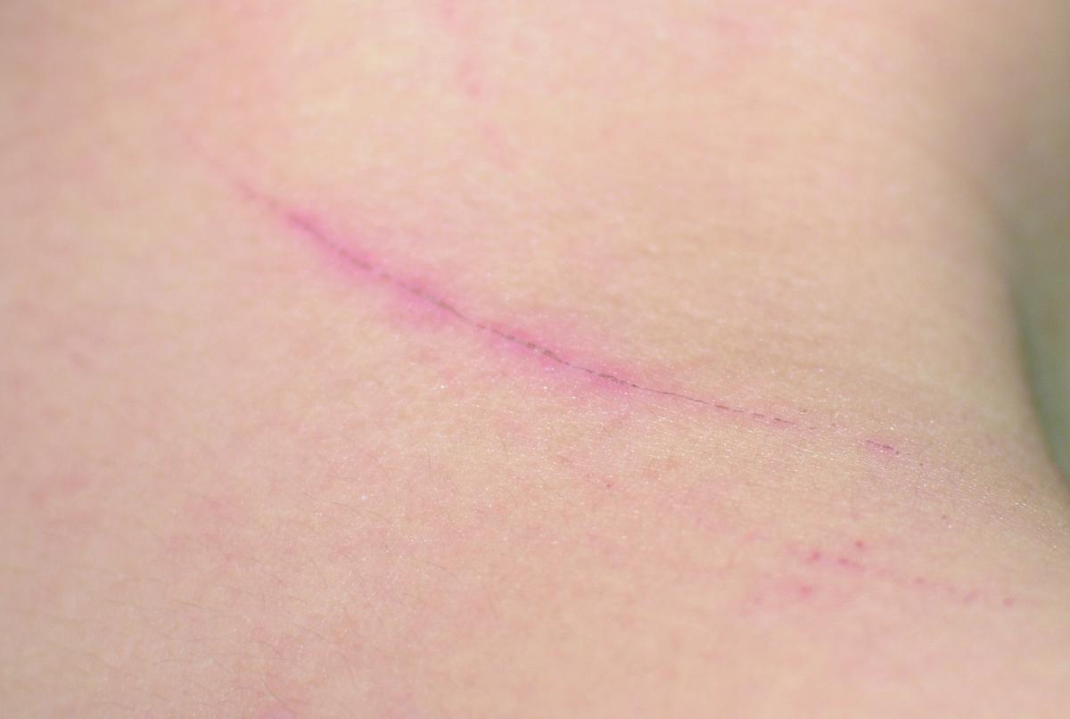 短暫的記憶_10的封面圖