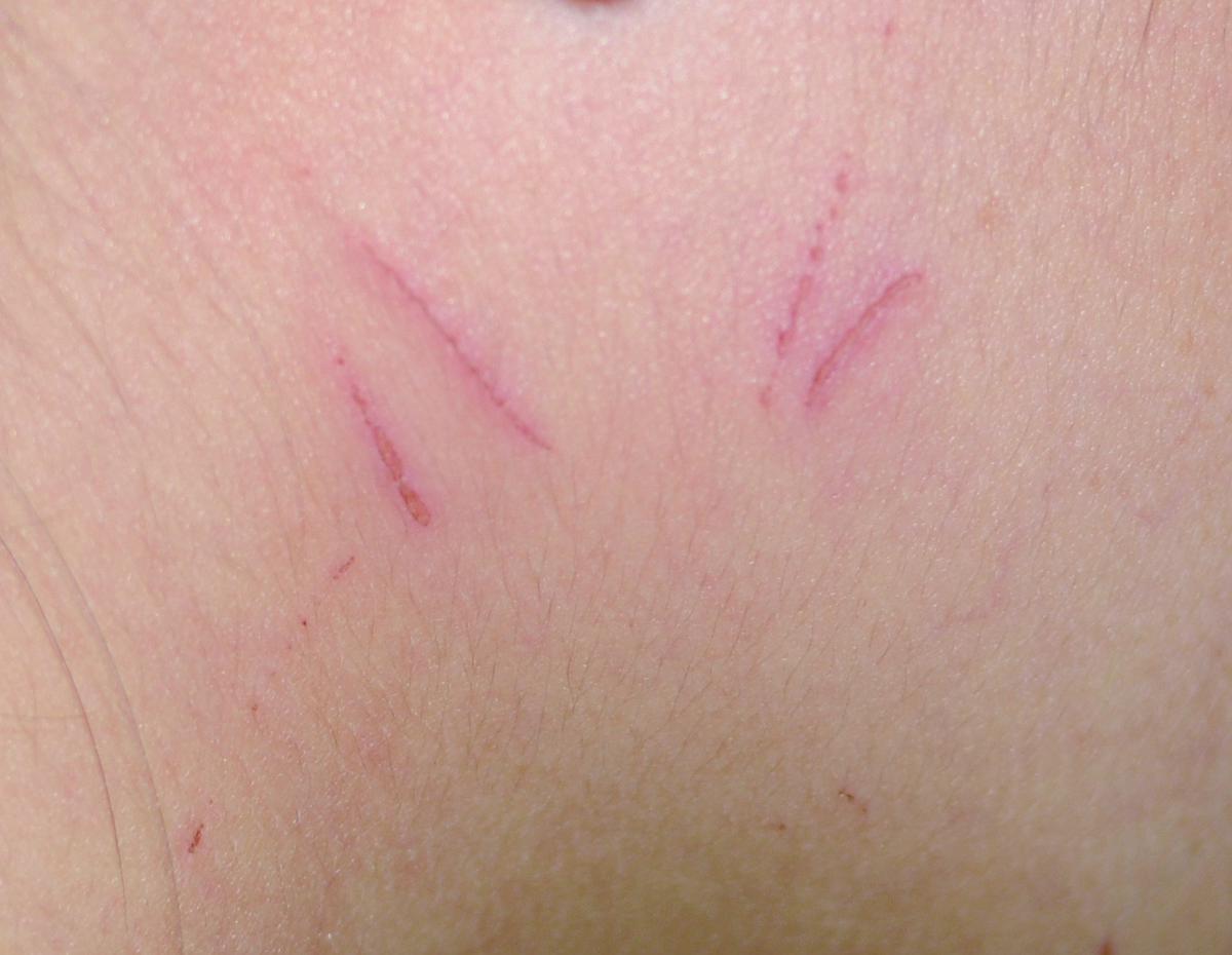 短暫的記憶_09的封面圖