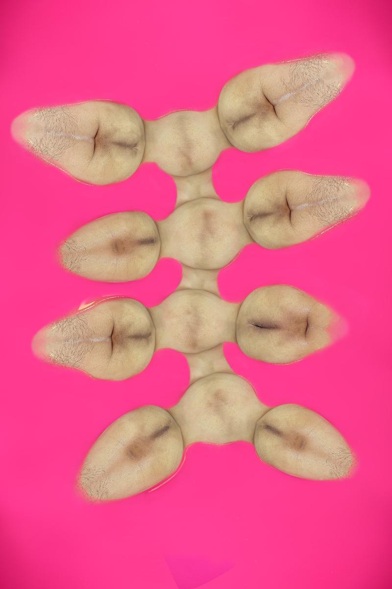 The Injection of Rubber Prostate—11's Cover