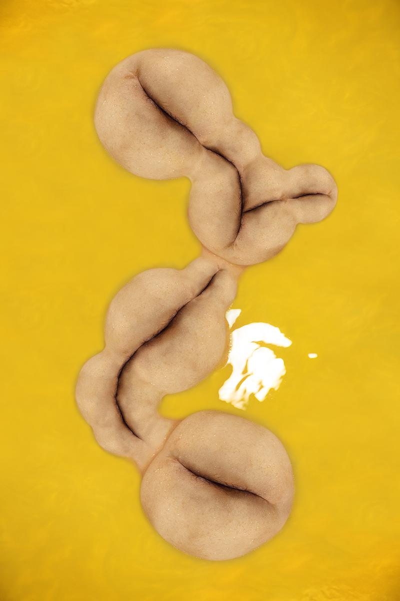 The Injection of Rubber Prostate—10's Cover