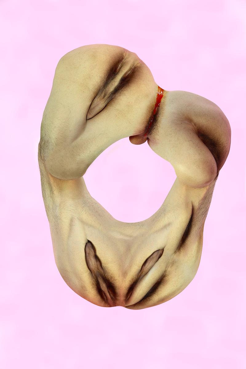 The Injection of Rubber Prostate—3's Cover