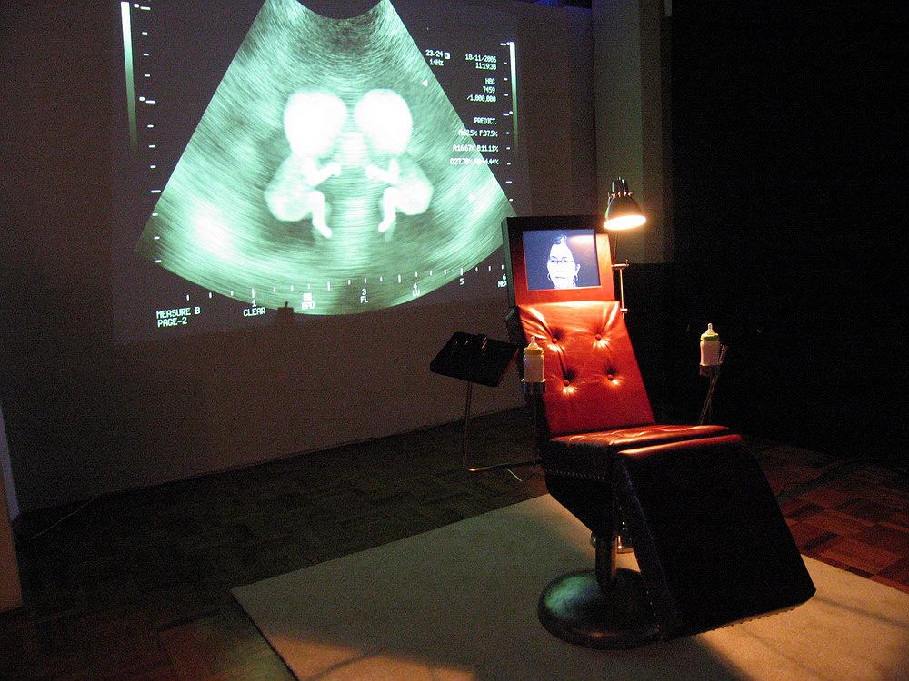 million heartbeats-02的封面圖