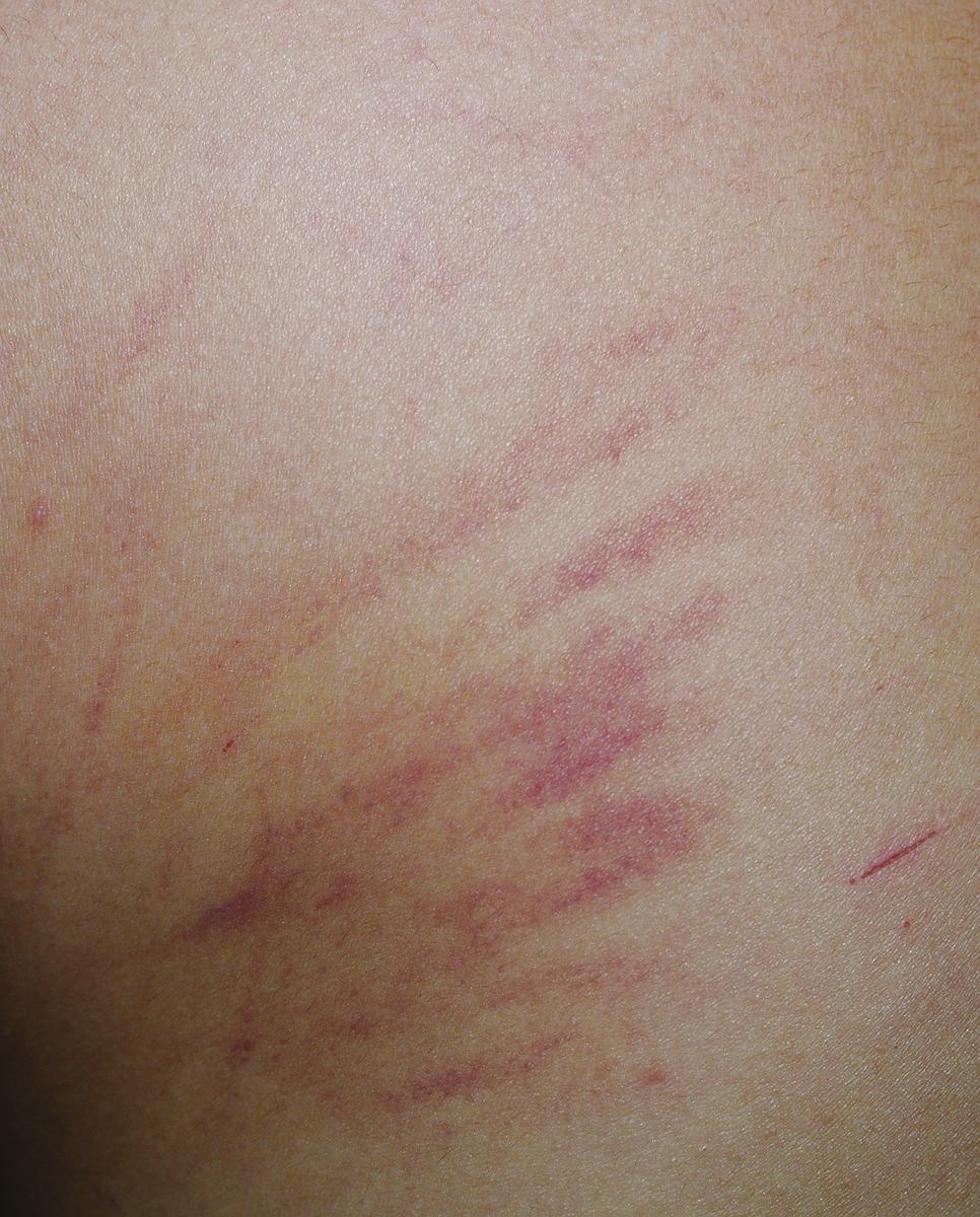 短暫的記憶_14的封面圖