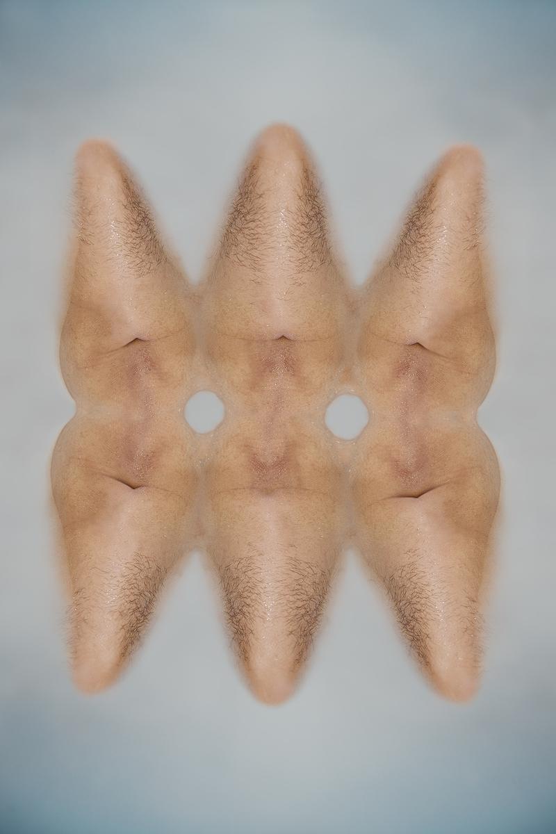 The Injection of Rubber Prostate—7's Cover