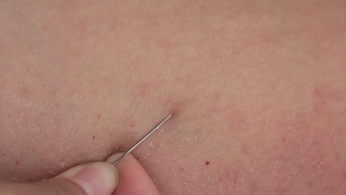 表層皮膚_02的封面圖