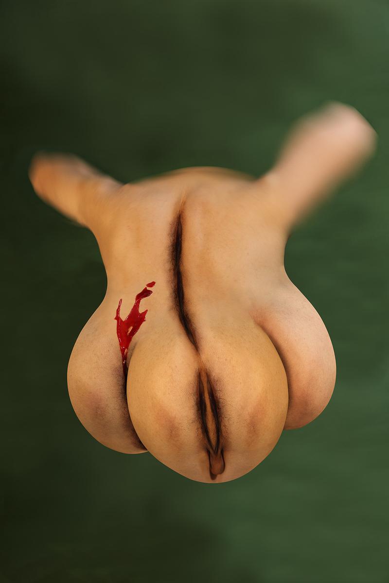 The Injection of Rubber Prostate—6's Cover